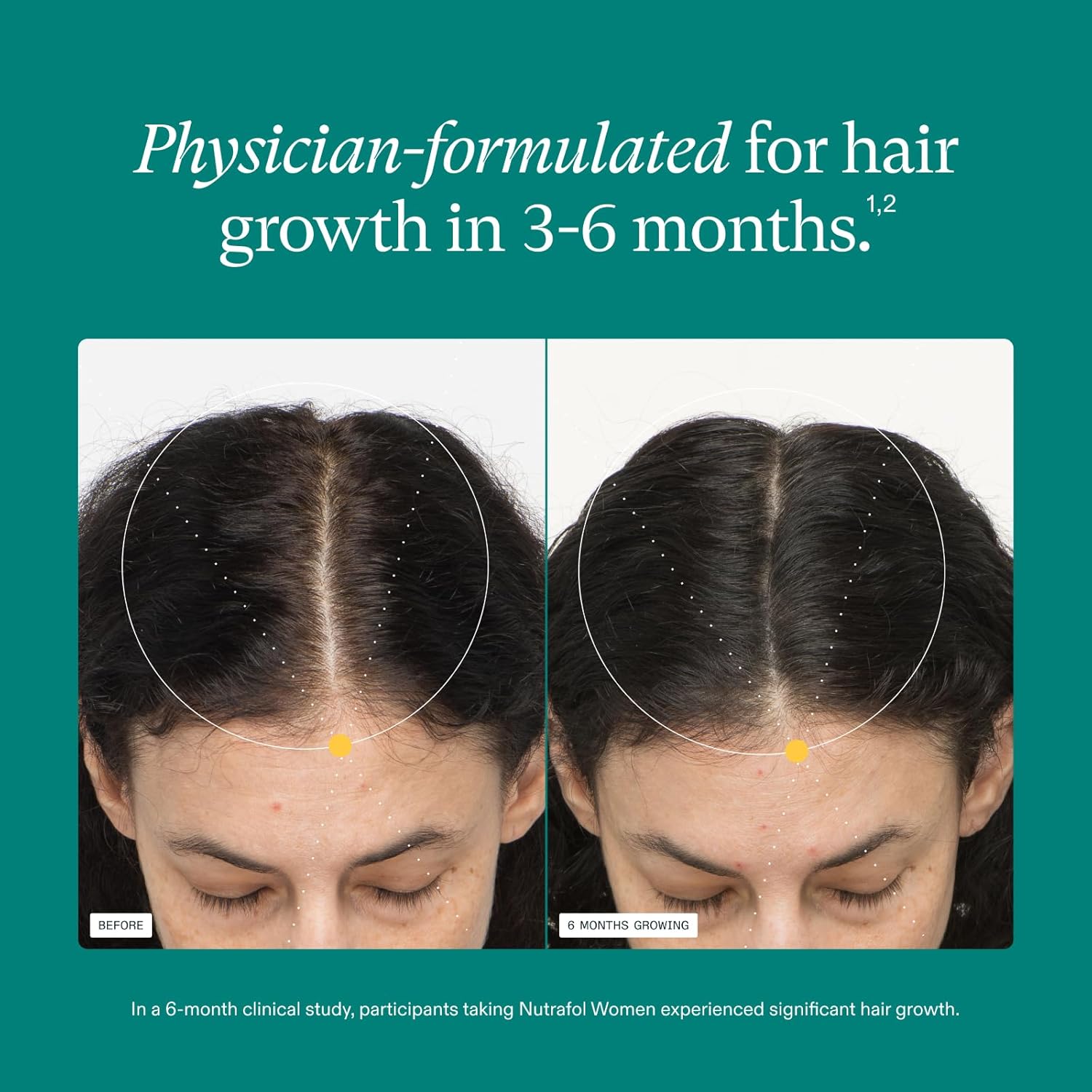 Nutrafol Women's Hair Growth Supplements, for Women Ages 18-44, Clinically Proven Hair Supplement for Visibly Thicker and Stronger Hair, Dermatologist Recommended - 1 Month Supply, 1 Refill Pouch - Image 4