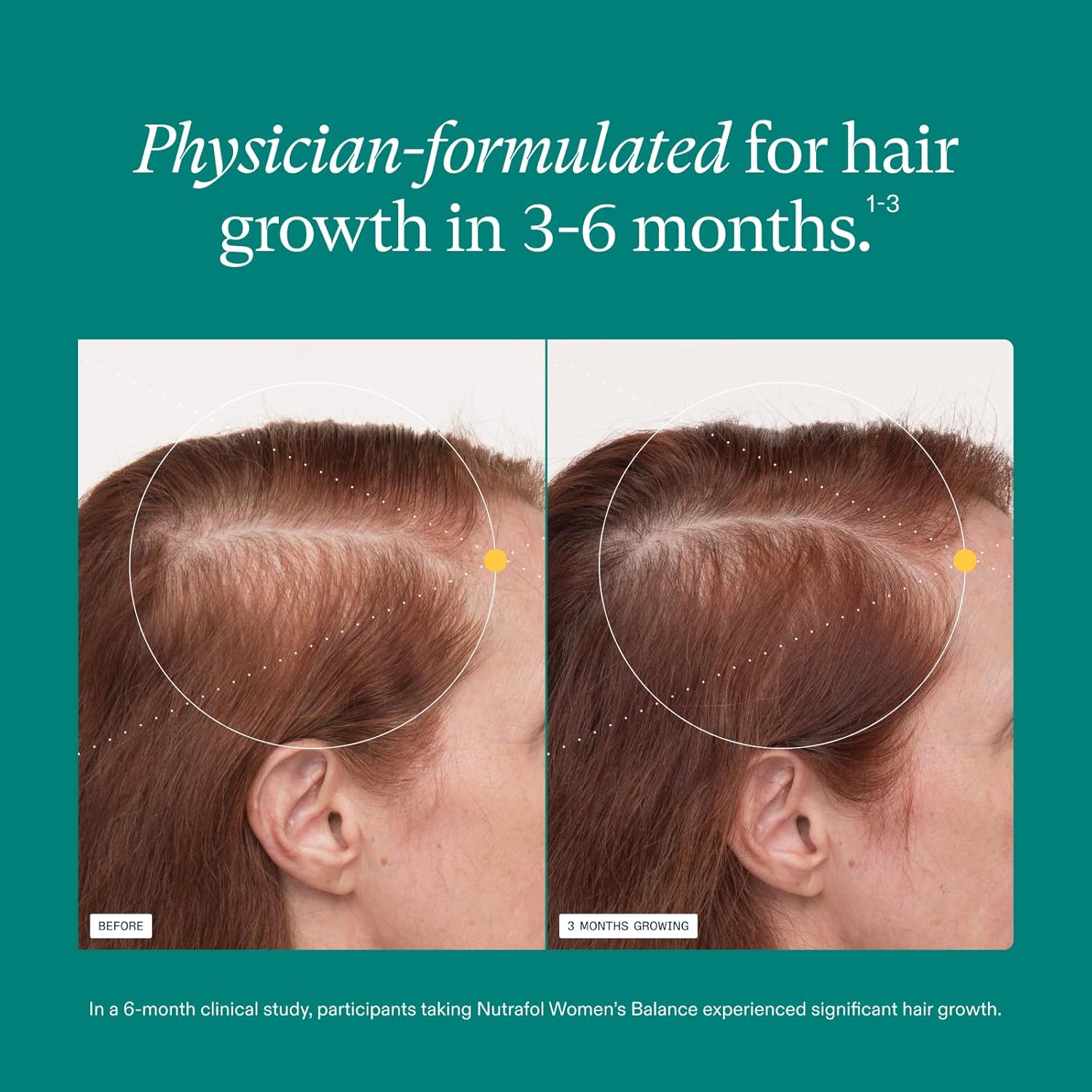 Nutrafol Women's Balance Hair Growth Supplements, for Ages 45+, Clinically Proven for Visibly Thicker Hair and Scalp Coverage, Dermatologist Recommended - 2 Month Supply, 2 Refill Pouches - Image 4