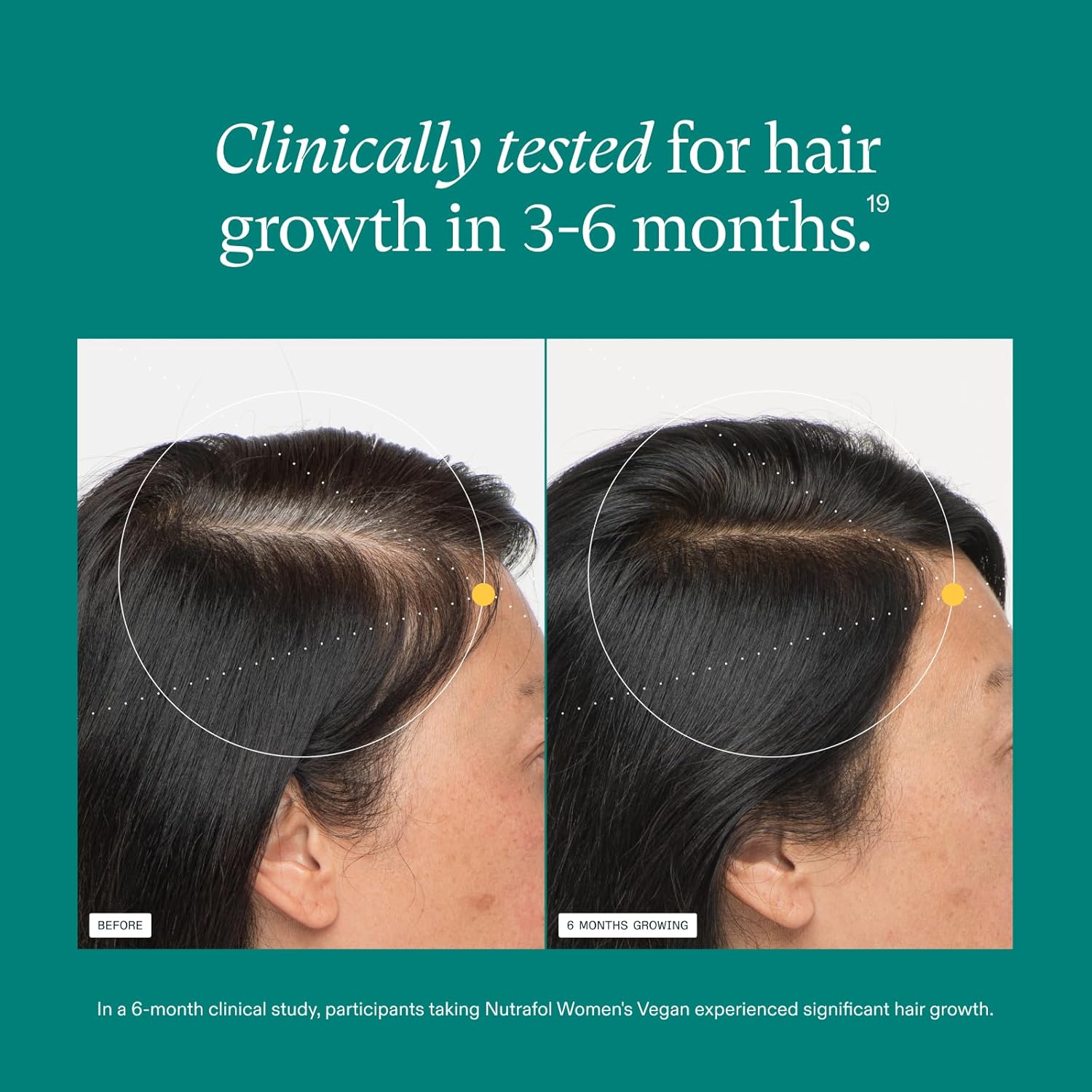 Nutrafol Women's Hair Growth Supplements, for Women 18-44 Years Old, Clinically Tested for Visibly Thicker, Stronger Hair, 100% Vegan Ingredients, Dermatologist Recommended - 1 Month Supply - Image 4