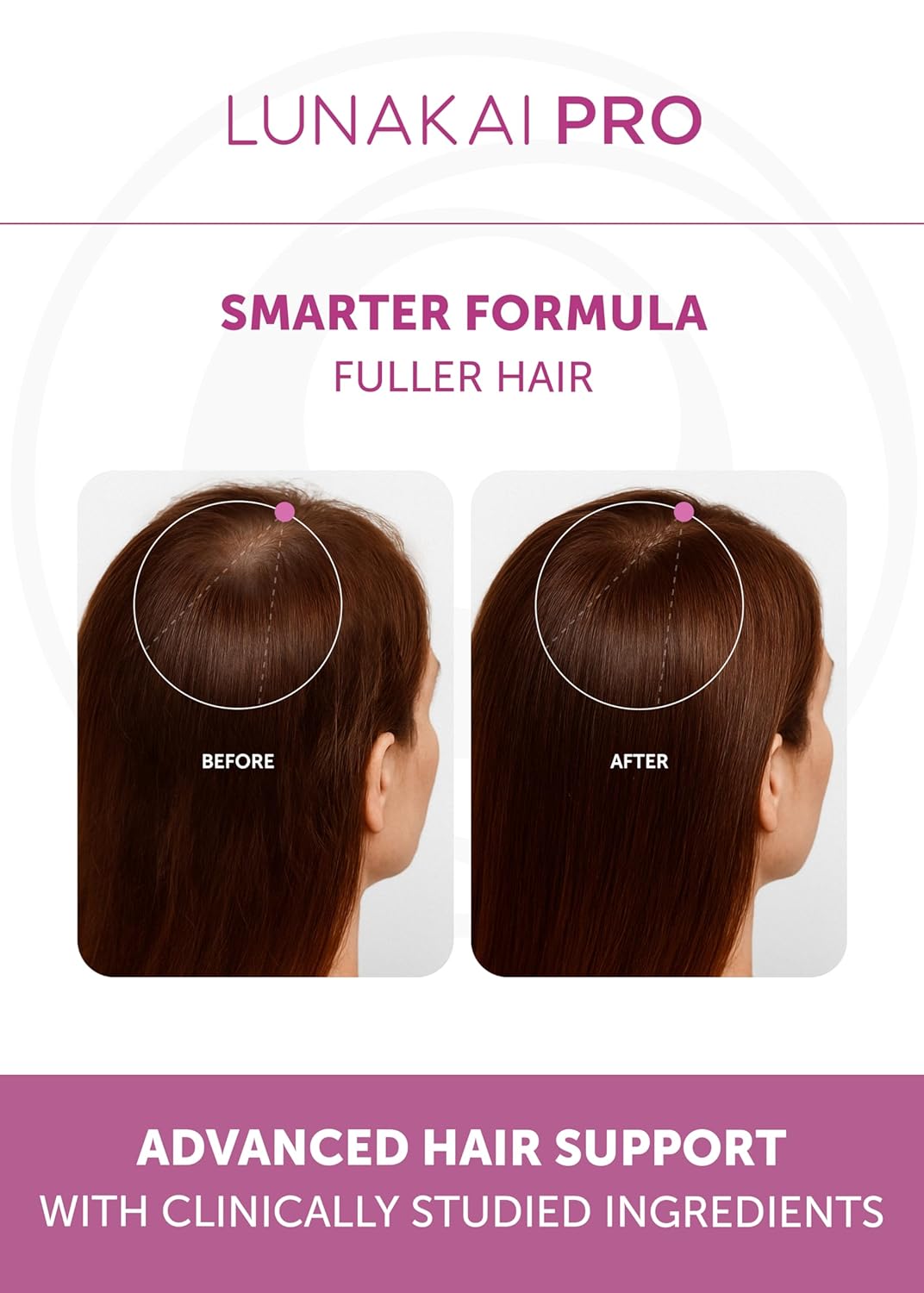 Lunakai USA Made Hair Growth Supplement for Women - Advanced 20 Nutrient with Marine Collagen, Saw Palmetto, Biotin & Keratin - Daily Hair Vitamins for Thicker Strands - 90 Capsules - Image 4