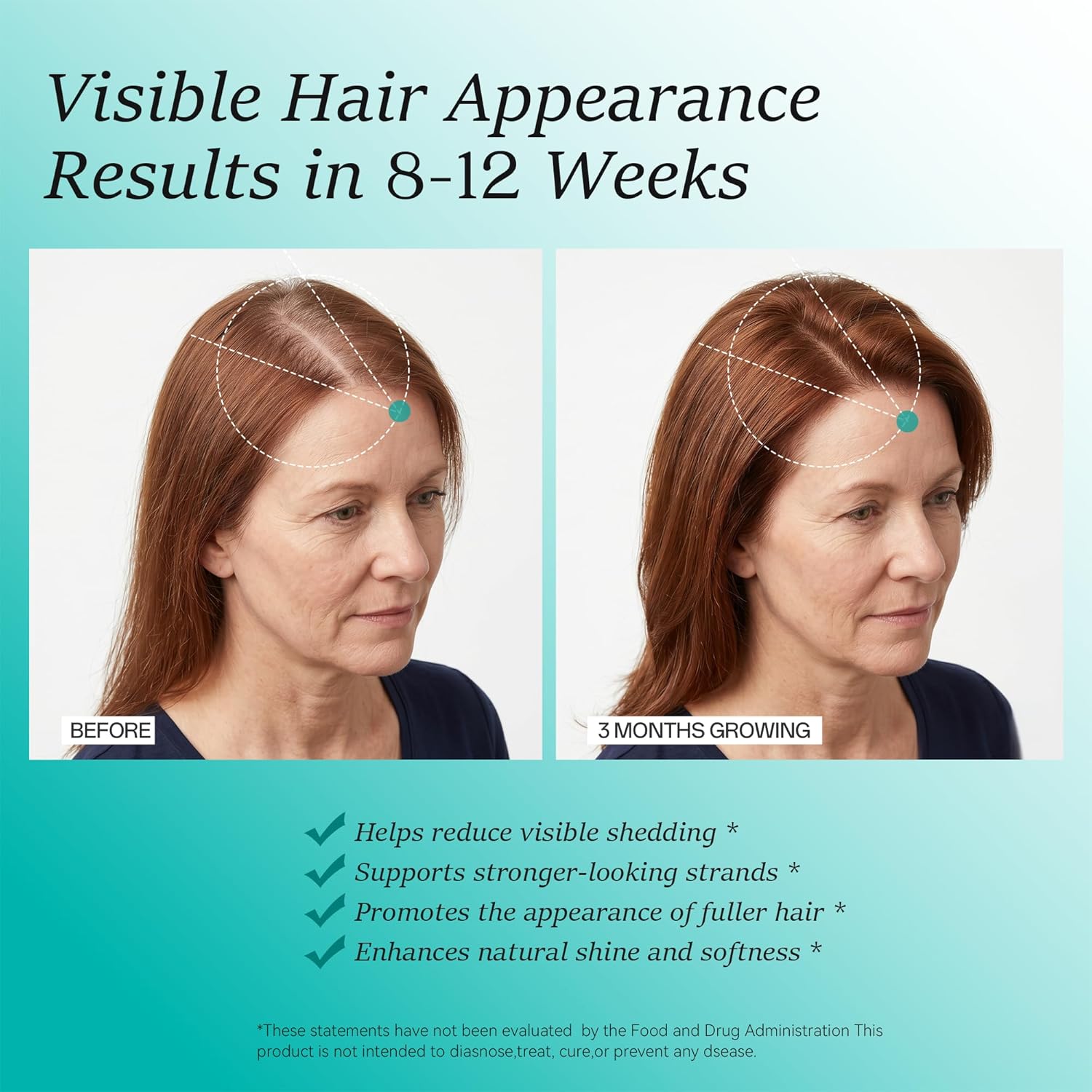 Hair Growth Supplements for Women, Ages 30 and Up - Clinically Tested for Visibly Thicker Hair with Biotin 10,000mcg, Vitamins, Keratin, Collagen, Saw Palmetto, Supports Scalp, Skin & Nails, 120 ct - Image 4
