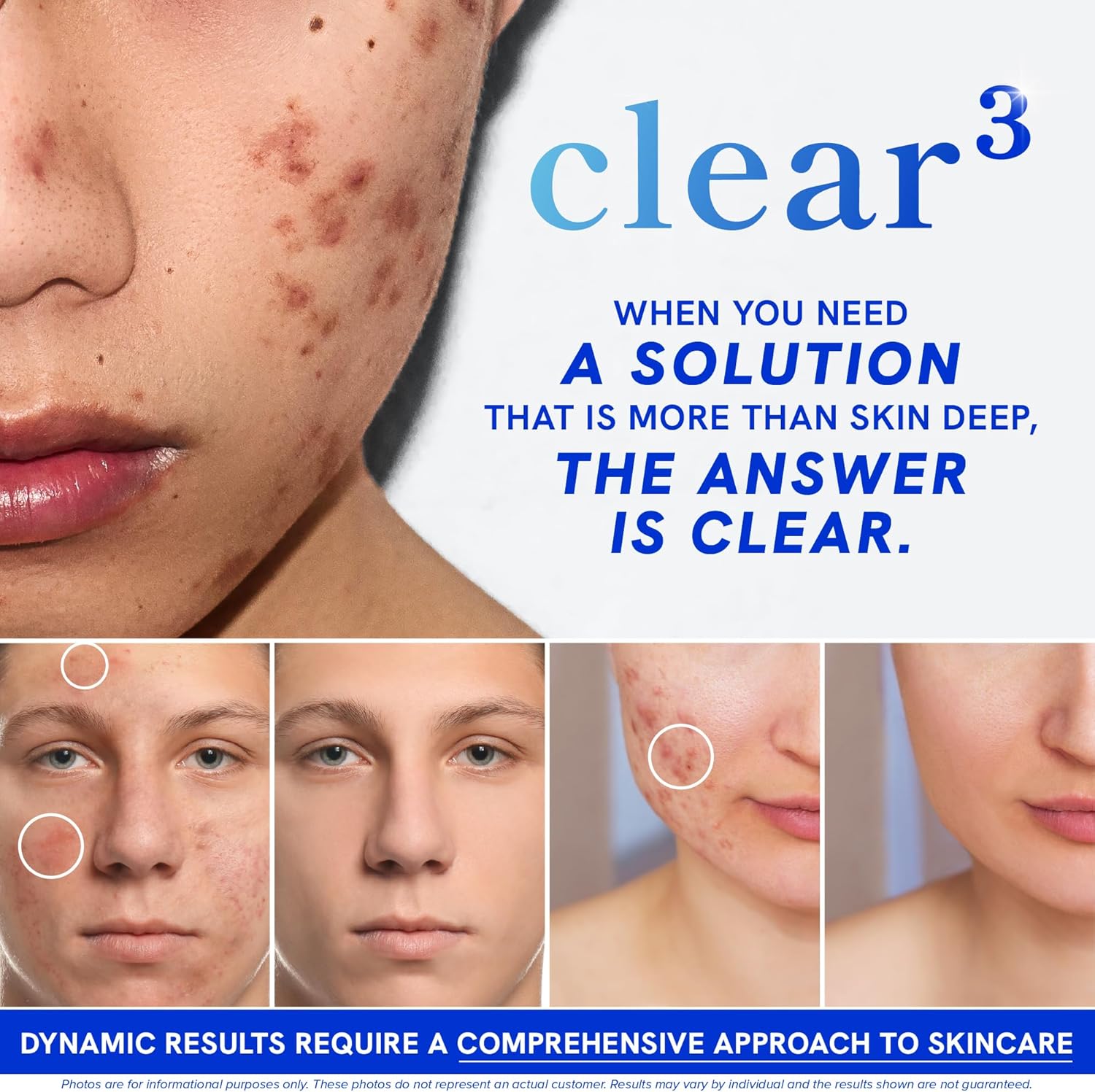 Clear Skin Supplement with Zinc, DIM & Probiotics | 3-in-1 Hormone, Gut & Complexion Support | Triple Action Hyaluronic Acid, Niaciminide & Vitamins for Skin Balance, Glow & Health Support | 180 Ct - Image 3