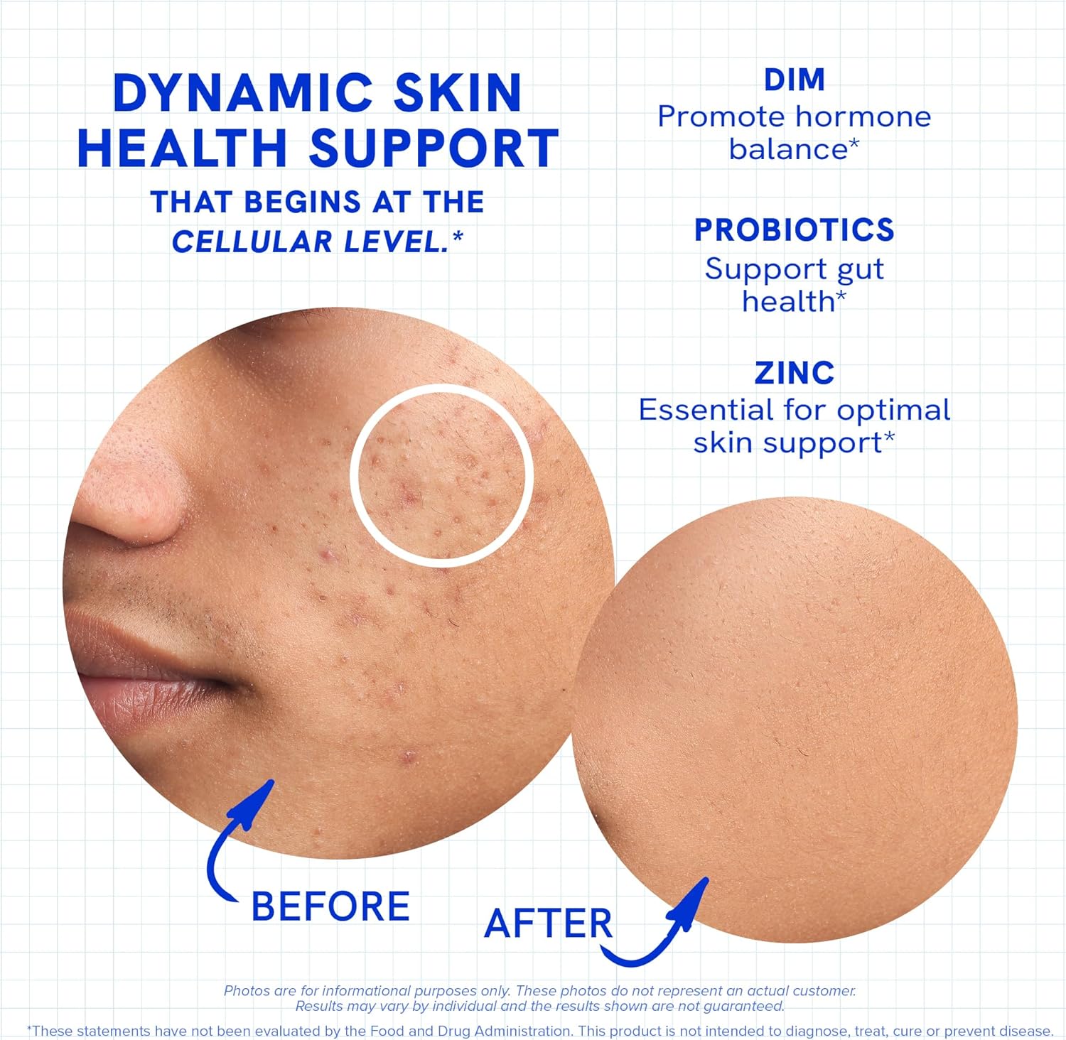 Clear Skin Supplement with Zinc, DIM & Probiotics | 3-in-1 Hormone, Gut & Complexion Support | Triple Action Hyaluronic Acid, Niaciminide & Vitamins for Skin Balance, Glow & Health Support | 180 Ct - Image 5